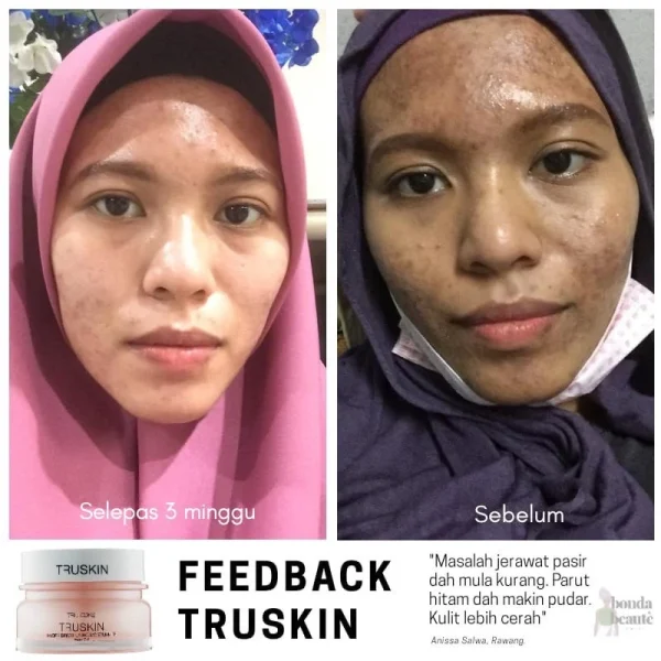 🎁FREEGIFT‼️TRUSKIN HYDRA BRIGHTENING MOISTURIZER TAHAN 72 JAM‼️ 18ml & 40ml Favorite Mua Bellaz Moisturizer - Image 4